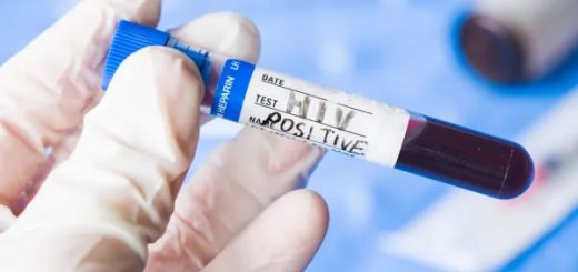 Día Mundial del Sida