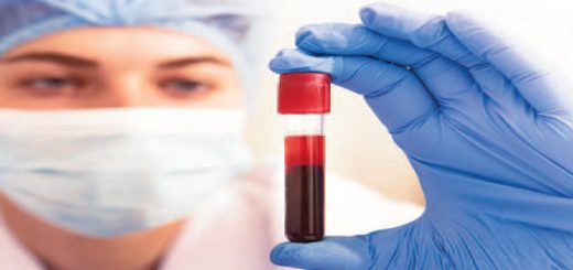 Alzheimer análisis de sangre