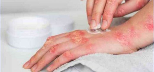 Seis casos de la viruela del mono en Ecuador corresponden a una cepa anterior, aclara el MSP